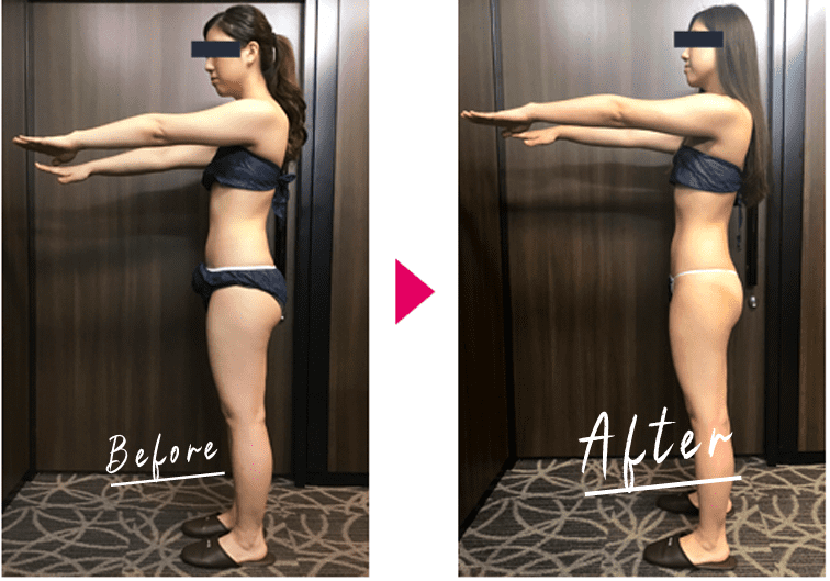 BeforeAfter画像