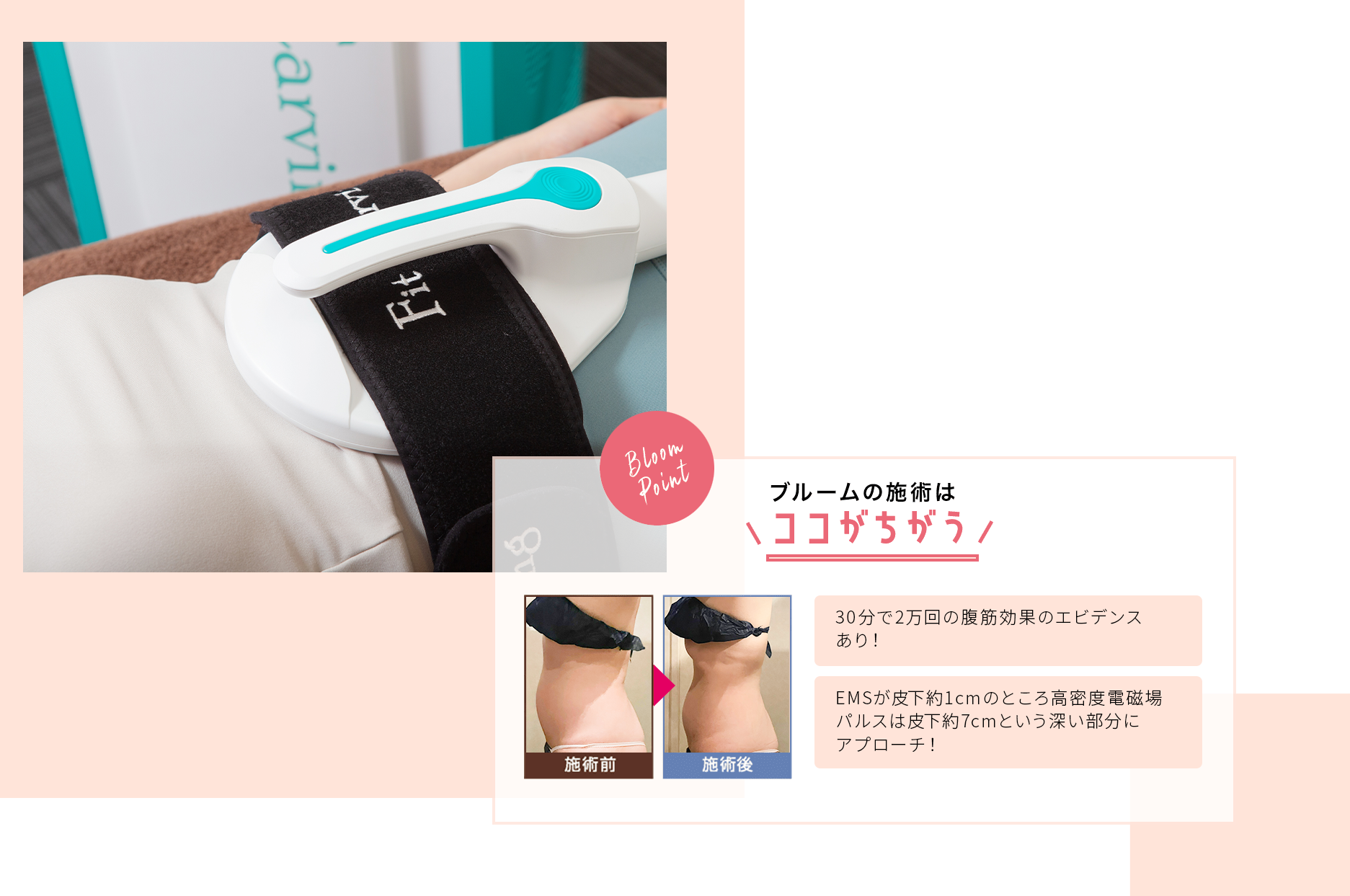 フィットカービング