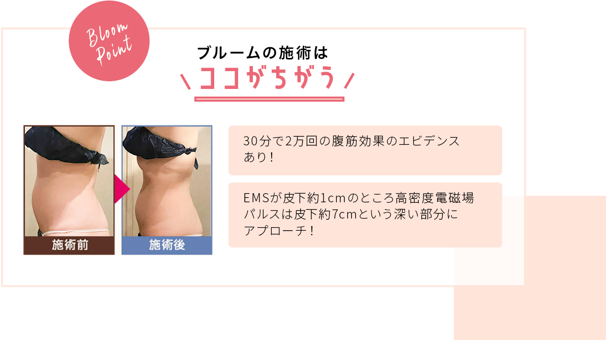 フィットカービング